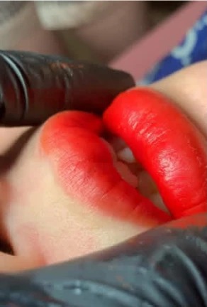 Đôi môi sau phun với tông đỏ tự nhiên